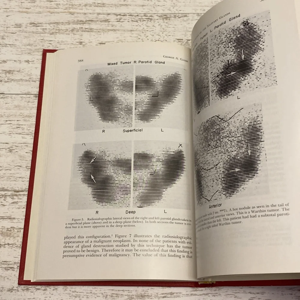 Vintage 1977 Otolaryngologic Clinics North America Salivary Gland Book